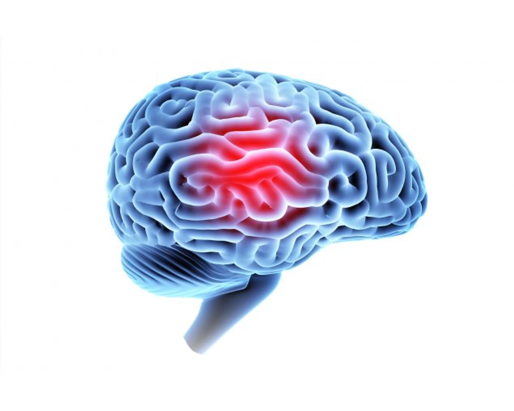 Read more about the article What you should know about traumatic brain injuries (TBI)