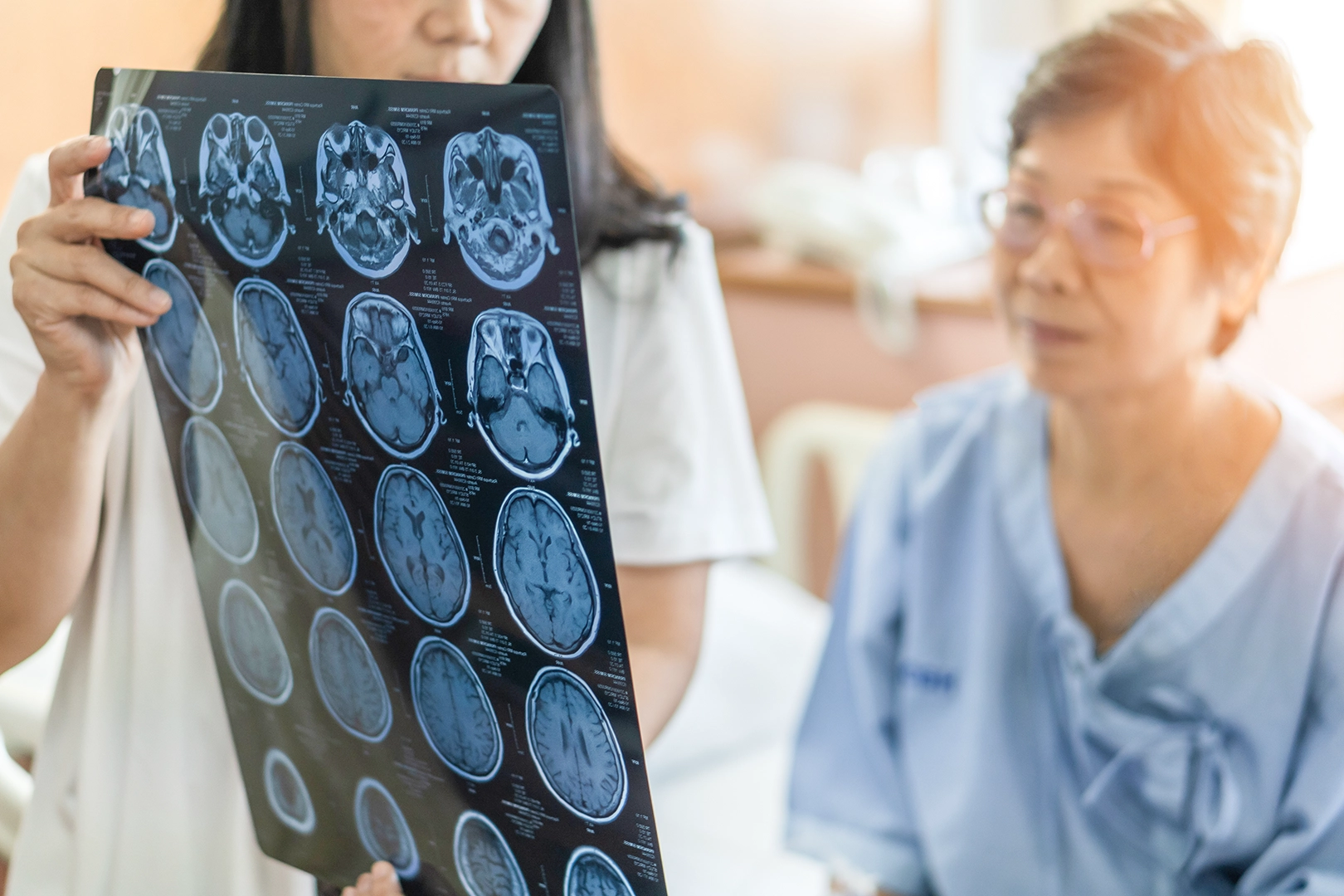 Read more about the article A guide to understanding, preventing, and recovering from stroke
